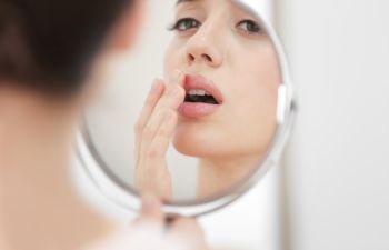 young woman with cold sores looking at her lips and mouth in a mirror